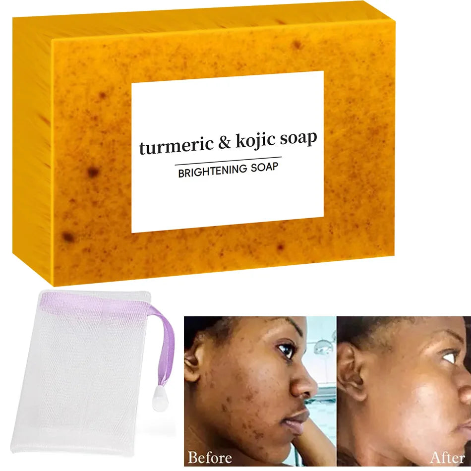 Turmeric & Kojic Acid Brightening Soap