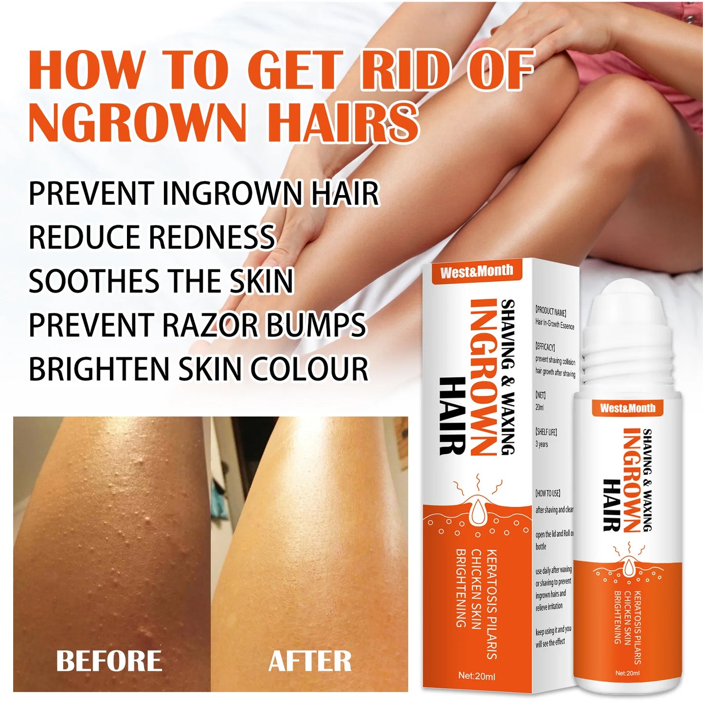 Ingrown Hair Treatment Serum