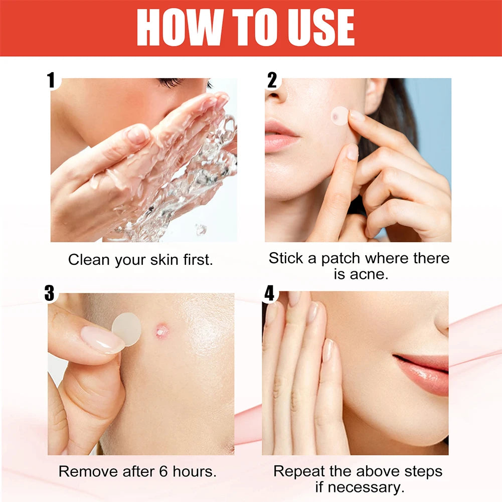 Hydrocolloid Acne Pimple Patches