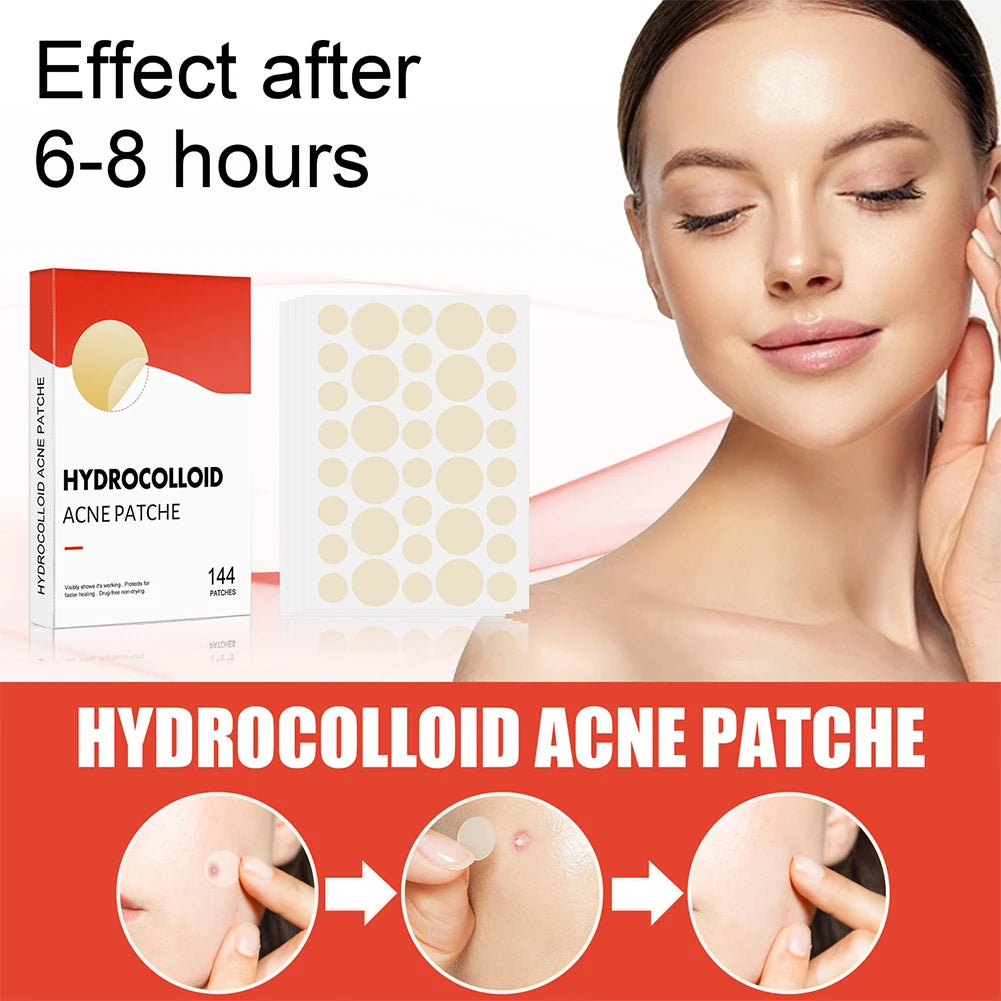 Hydrocolloid Acne Pimple Patches