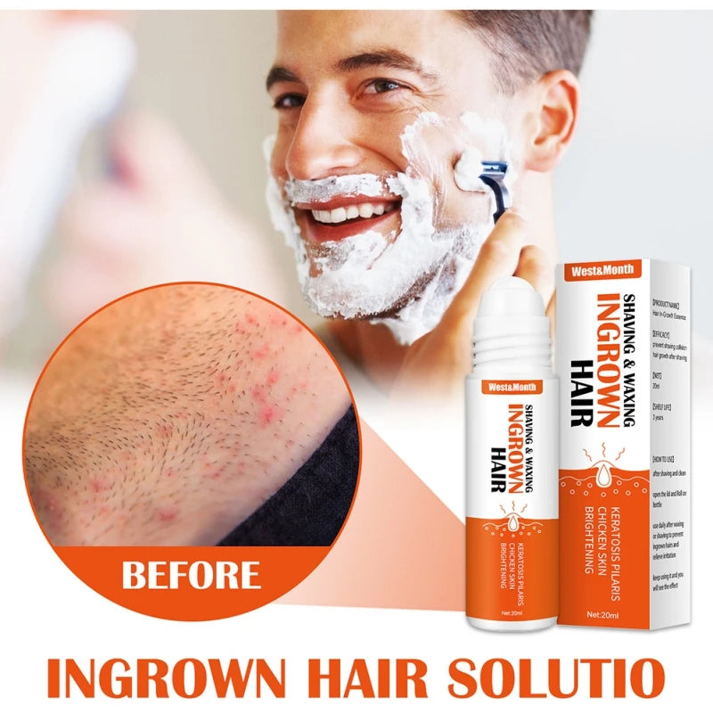 Ingrown Hair Treatment Serum
