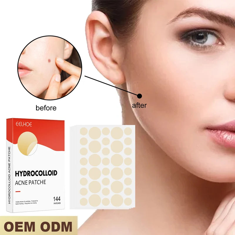 Hydrocolloid Acne Pimple Patches