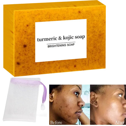 Turmeric & Kojic Acid Brightening Soap