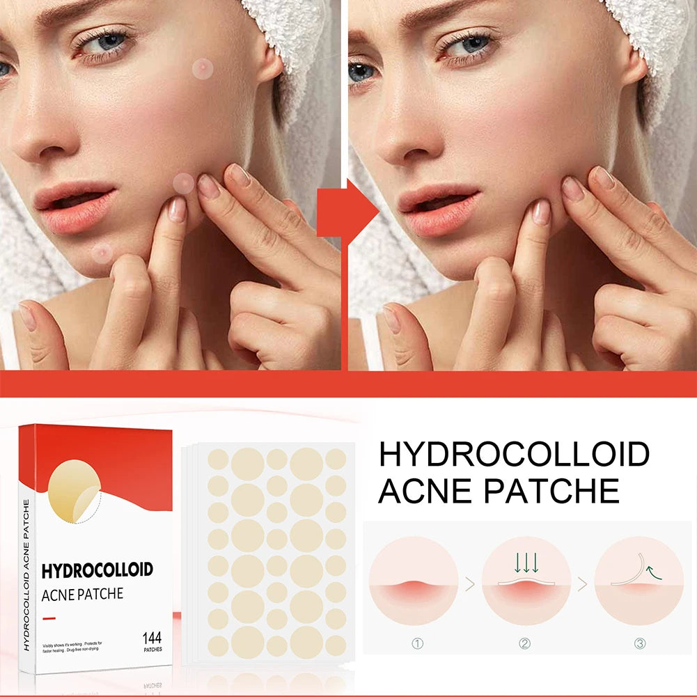 Hydrocolloid Acne Pimple Patches