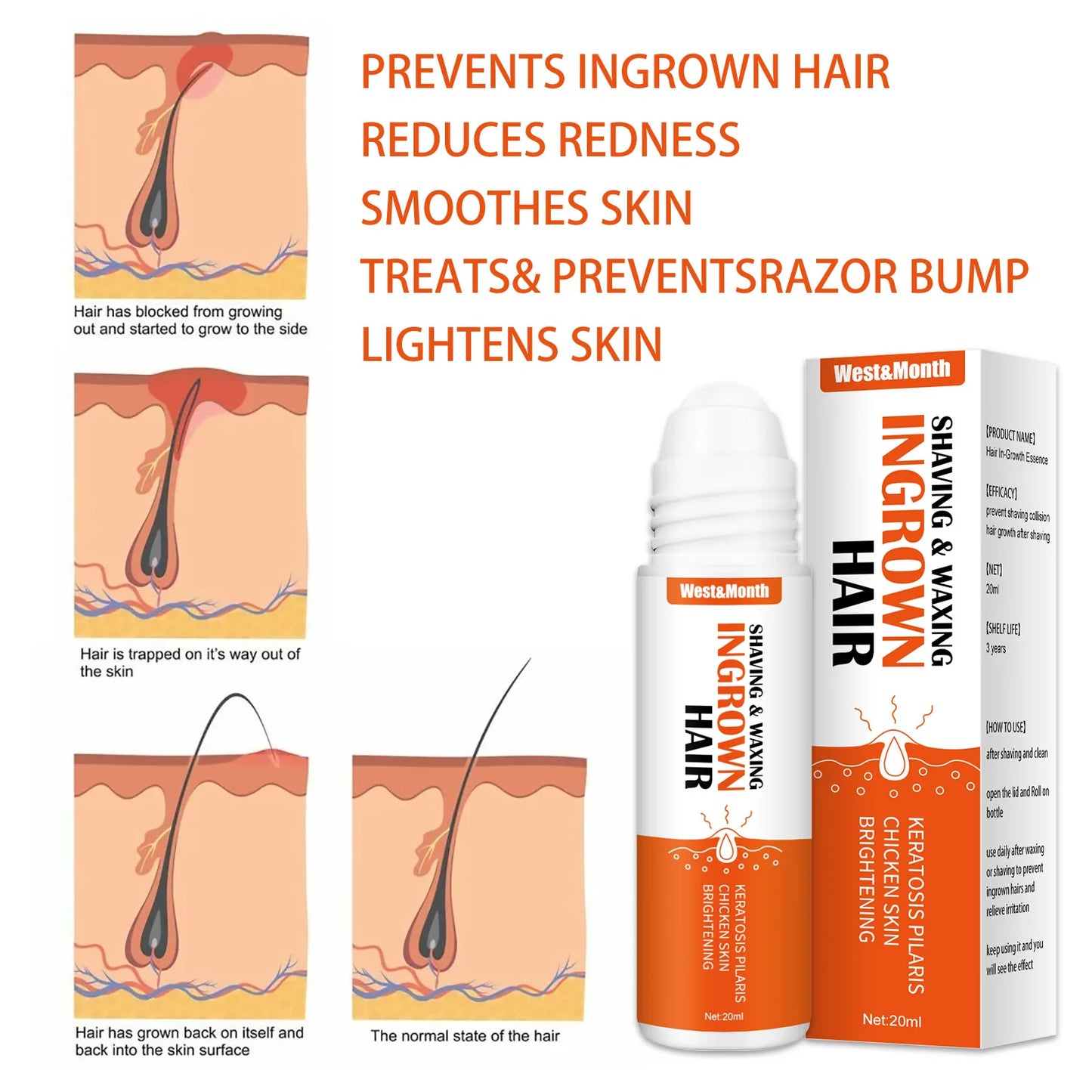 Ingrown Hair Treatment Serum