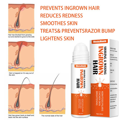 Ingrown Hair Treatment Serum