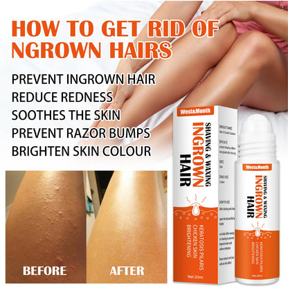 Ingrown Hair Treatment Serum